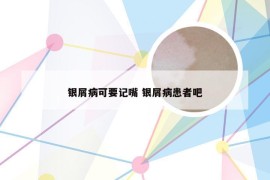 银屑病可要记嘴 银屑病患者吧