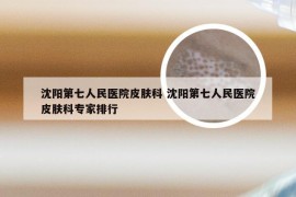 沈阳第七人民医院皮肤科 沈阳第七人民医院皮肤科专家排行