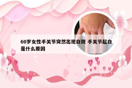 60岁女性手关节突然出现白斑 手关节起白是什么原因