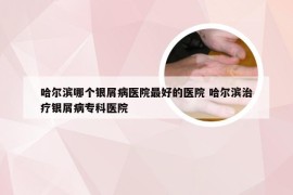 哈尔滨哪个银屑病医院最好的医院 哈尔滨治疗银屑病专科医院