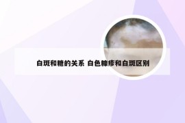 白斑和糖的关系 白色糠疹和白斑区别