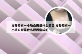 皮秒后有一小块白斑是什么原因 皮秒后有一小块白斑是什么原因造成的