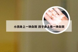 小孩身上一块白斑 孩子身上有一块白斑