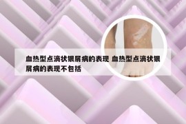 血热型点滴状银屑病的表现 血热型点滴状银屑病的表现不包括