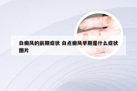 白癜风的前期症状 白点癫风早期是什么症状图片