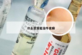 什么软膏能治牛皮癣