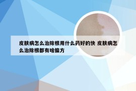 皮肤病怎么治除根用什么药好的快 皮肤病怎么治除根都有啥偏方