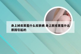 身上掉皮屑是什么皮肤病 身上脱皮屑是什么原因引起的