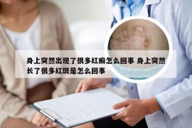 身上突然出现了很多红癣怎么回事 身上突然长了很多红斑是怎么回事