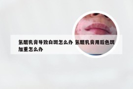 氢醌乳膏导致白斑怎么办 氢醌乳膏用后色斑加重怎么办