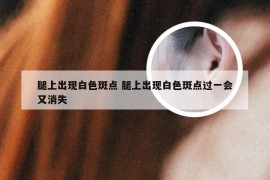 腿上出现白色斑点 腿上出现白色斑点过一会又消失