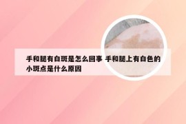 手和腿有白斑是怎么回事 手和腿上有白色的小斑点是什么原因