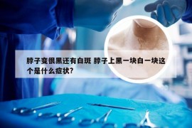 脖子变很黑还有白斑 脖子上黑一块白一块这个是什么症状?