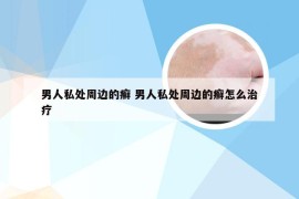 男人私处周边的癣 男人私处周边的癣怎么治疗