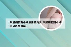 银屑病初期小红点用的药膏 银屑病初期小红点可以根治吗