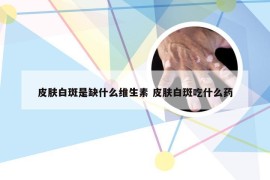 皮肤白斑是缺什么维生素 皮肤白斑吃什么药