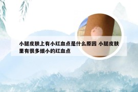 小腿皮肤上有小红血点是什么原因 小腿皮肤里有很多细小的红血点