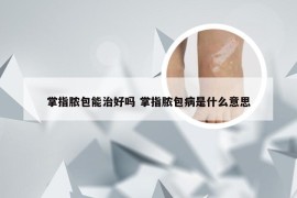 掌指脓包能治好吗 掌指脓包病是什么意思