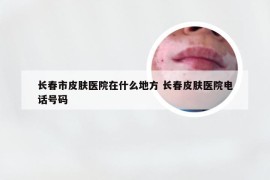 长春市皮肤医院在什么地方 长春皮肤医院电话号码