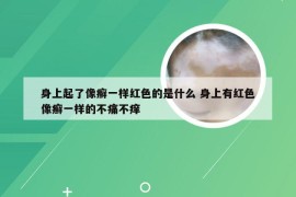 身上起了像癣一样红色的是什么 身上有红色像癣一样的不痛不痒