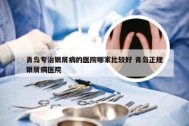 青岛专治银屑病的医院哪家比较好 青岛正规银屑病医院