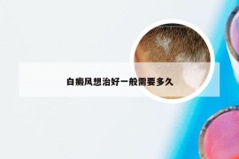 白癜风想治好一般需要多久