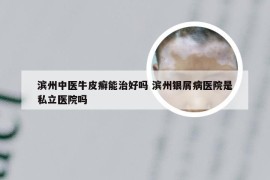 滨州中医牛皮癣能治好吗 滨州银屑病医院是私立医院吗