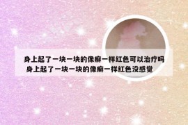 身上起了一块一块的像癣一样红色可以治疗吗 身上起了一块一块的像癣一样红色没感觉