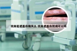 纹身能遮盖白癜风么 纹身遮盖白斑病可以吗