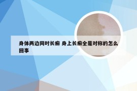 身体两边同时长癣 身上长癣全是对称的怎么回事