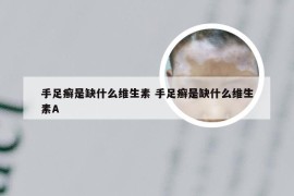 手足癣是缺什么维生素 手足癣是缺什么维生素A