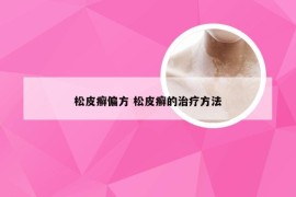 松皮癣偏方 松皮癣的治疗方法