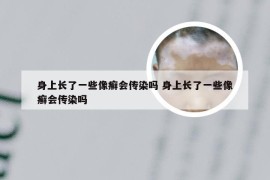 身上长了一些像癣会传染吗 身上长了一些像癣会传染吗