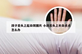 孩子舌头上起白斑图片 小孩舌头上长白点点怎么办