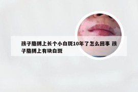 孩子胳膊上长个小白斑10年了怎么回事 孩子胳膊上有块白斑