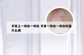 手背上一块白一块白 手背一块白一块白的是什么病