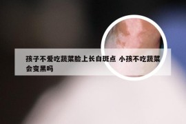 孩子不爱吃蔬菜脸上长白斑点 小孩不吃蔬菜会变黑吗