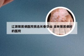 辽源银屑病医院我选长春华山 吉林银屑病好的医院