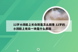 12岁小孩脸上长白斑是怎么回事 12岁的小孩脸上有白一块是什么原因