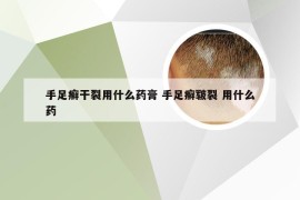 手足癣干裂用什么药膏 手足癣皲裂 用什么药