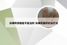 白癞风到底能不能治好 白癞风最好的治疗法