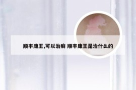 顺丰康王,可以治癣 顺丰康王是治什么的