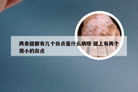 两条腿都有几个白点是什么病呀 腿上有两个很小的白点