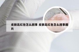 皮肤出红包怎么回事 皮肤出红包怎么回事图片