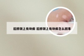 后脖颈上有块癣 后脖颈上有块癣怎么回事