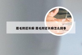 眉毛附近长癣 眉毛附近长癣怎么回事