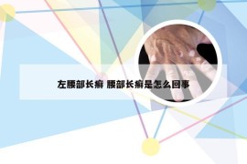 左腰部长癣 腰部长癣是怎么回事