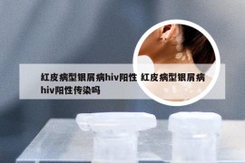 红皮病型银屑病hiv阳性 红皮病型银屑病hiv阳性传染吗