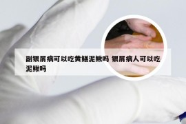 副银屑病可以吃黄鳝泥鳅吗 银屑病人可以吃泥鳅吗