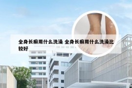 全身长癣用什么洗澡 全身长癣用什么洗澡比较好